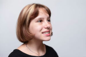 Beautiful young teenage girl smiles on a light background and shows that she has not straight teeth and malocclusion,