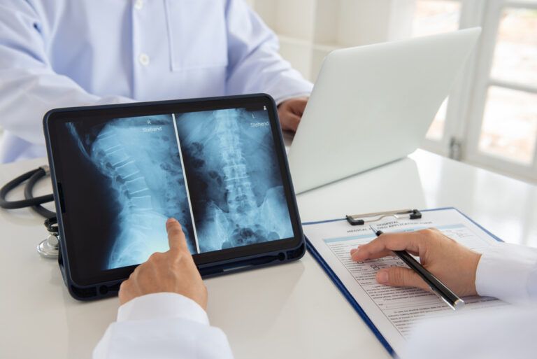 doctor diagnose spine lumber vertebrae x-ray image