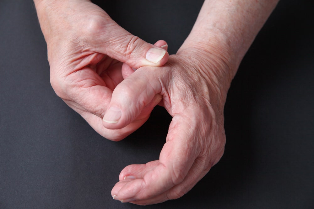 Thumb Arthritis