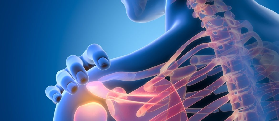 A,Painful,Shoulder,Joint,Involves,Discomfort,Or,Soreness,,Often,Limiting