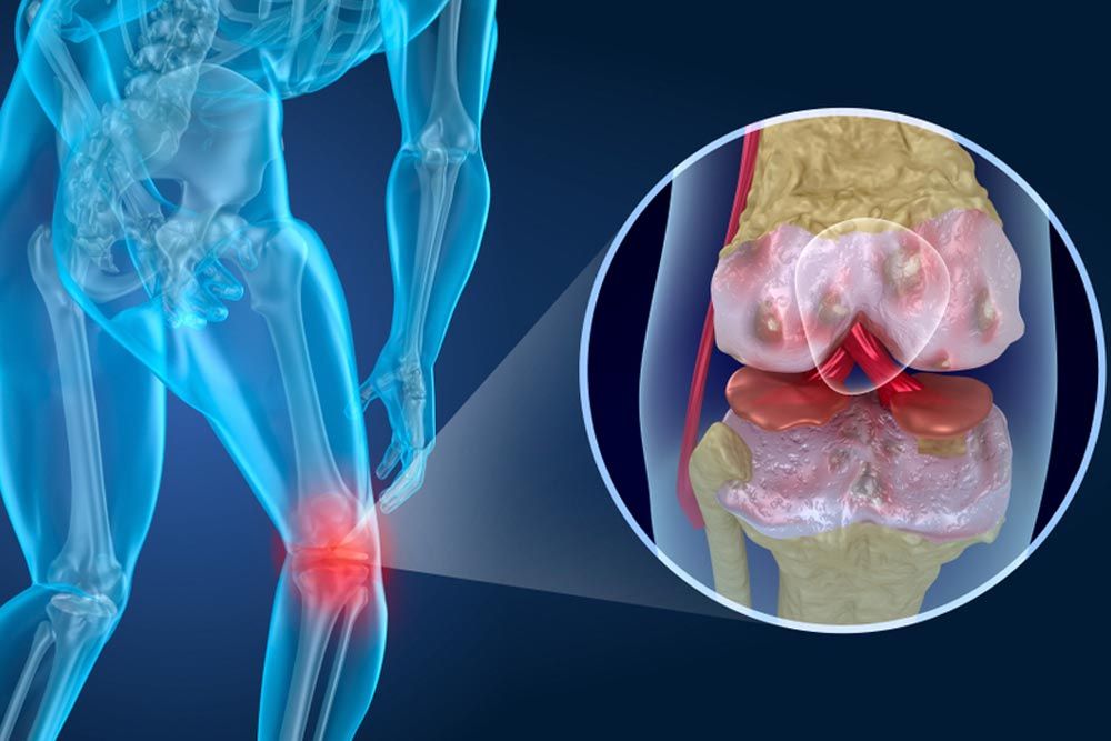 Knee pain Attack, man suffering from knee. 3D illustration