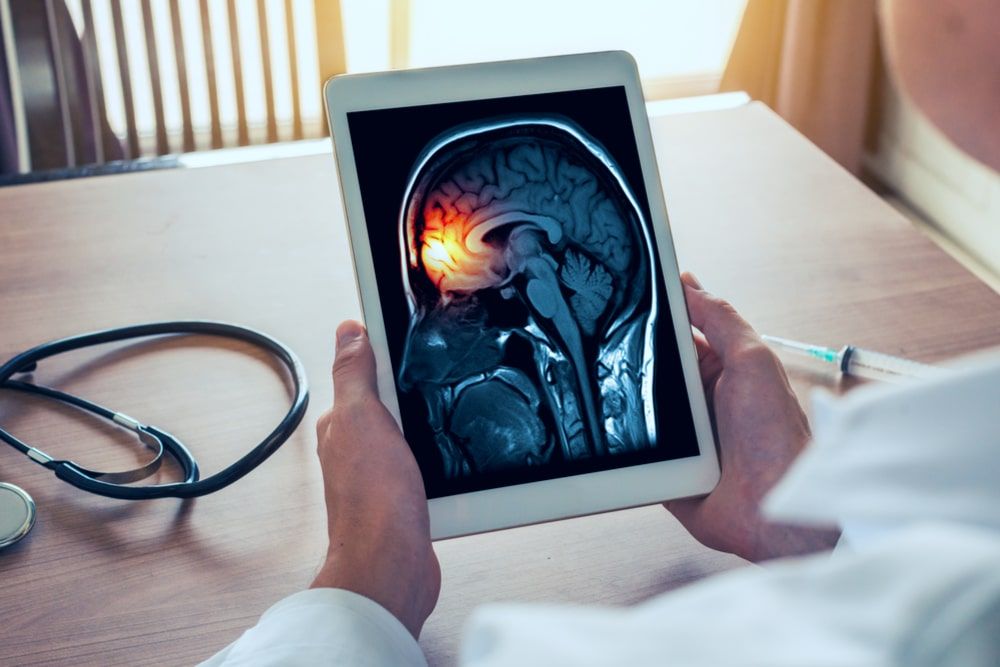 Doctor holding a digital tablet with x-ray of brain