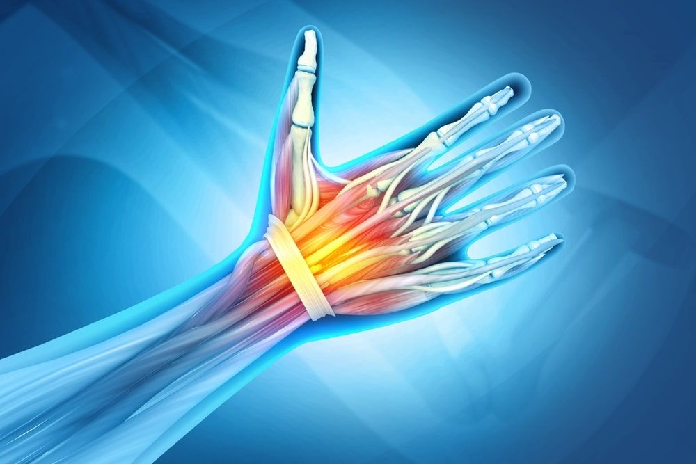 Wrist bones injury illustration