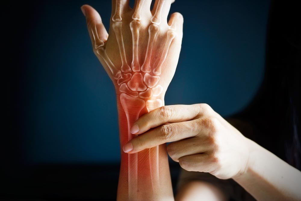 Acute pain in a woman wrist