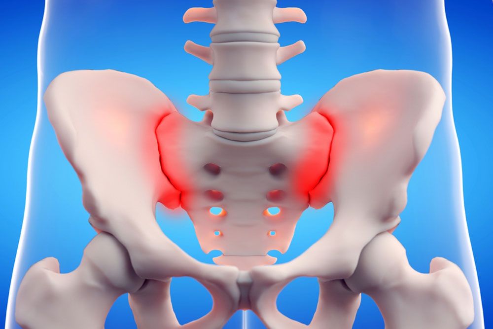 Sacroiliitis – Home Remedies vs. Therapies vs. Medical Treatment
