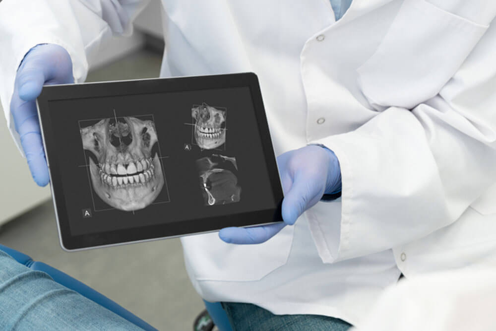 Dentist showing teeth x-ray on digital tablet screen