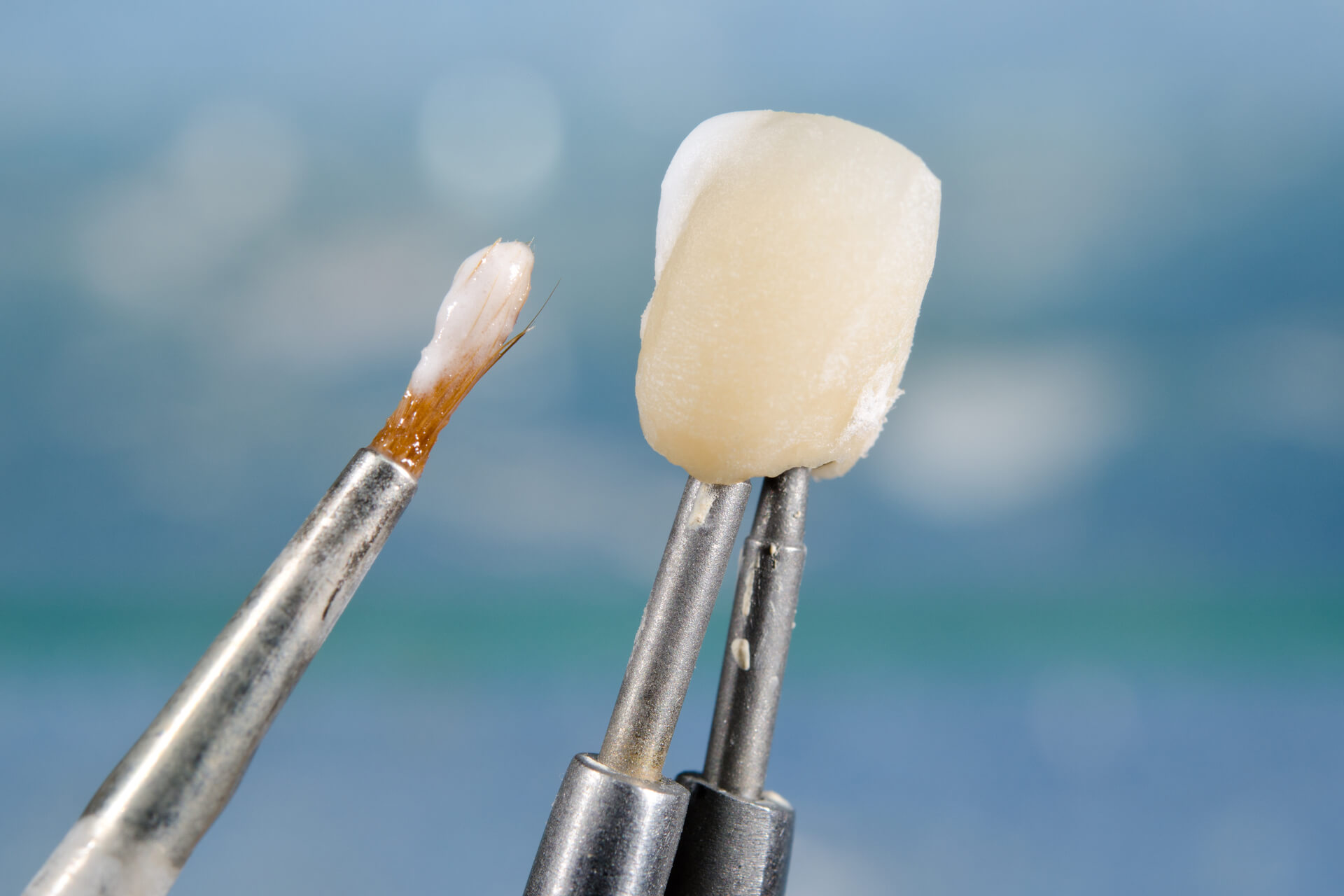 Applying ceramic material on crown, dental technology