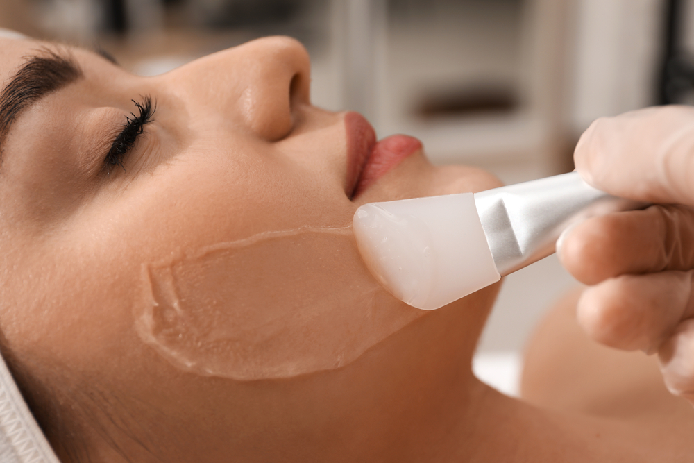 A woman receiving Chemical Peels 