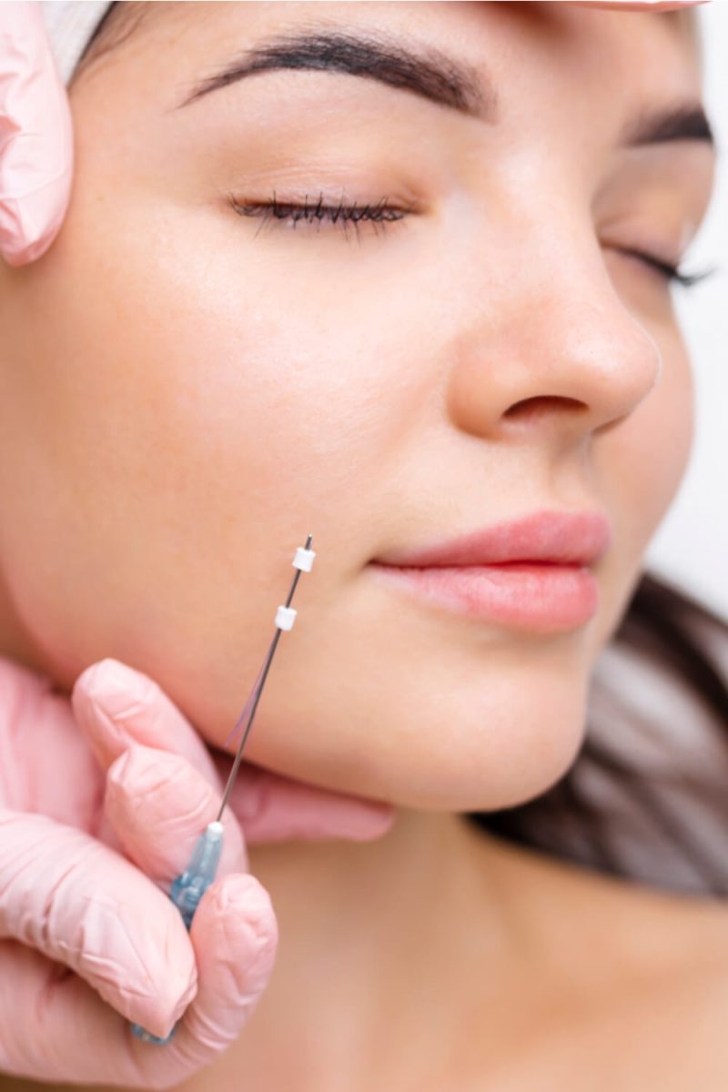 Woman having thread lift treatment