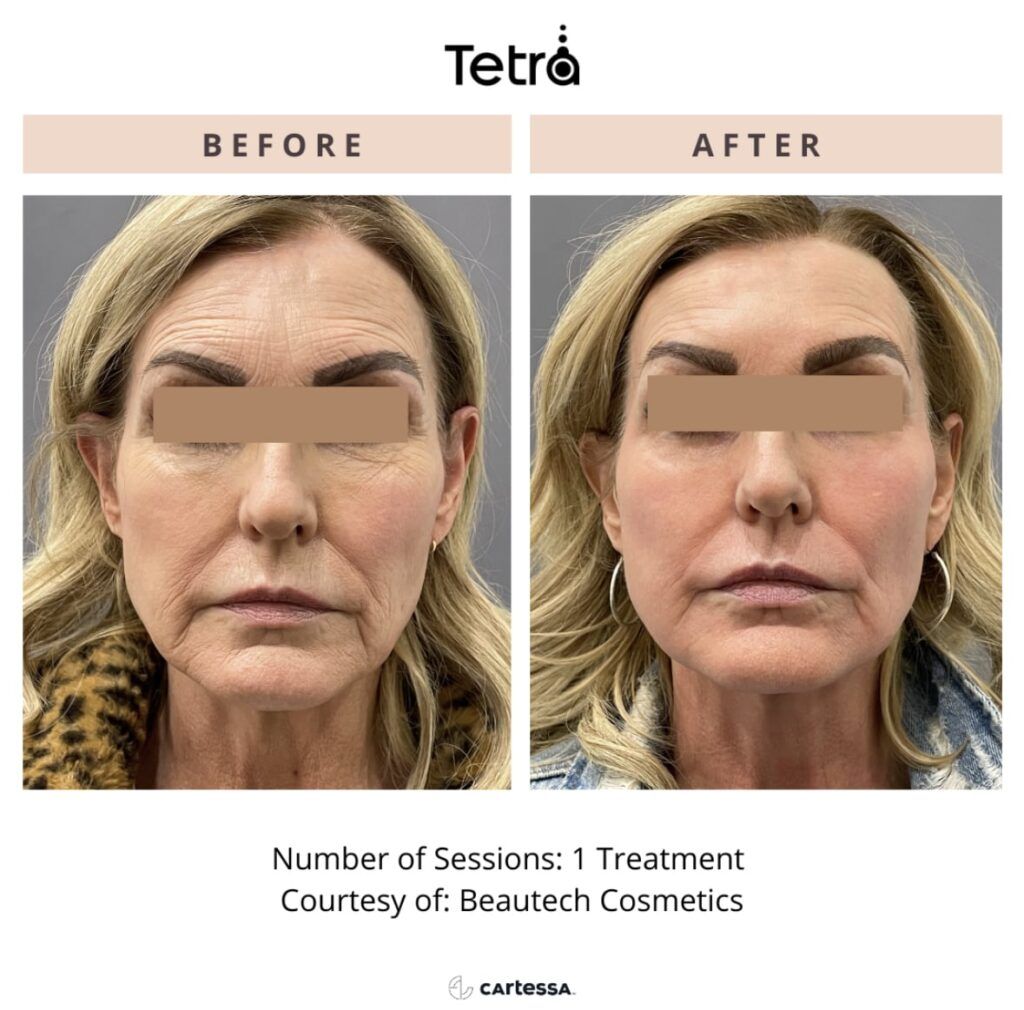 Before after treatment image