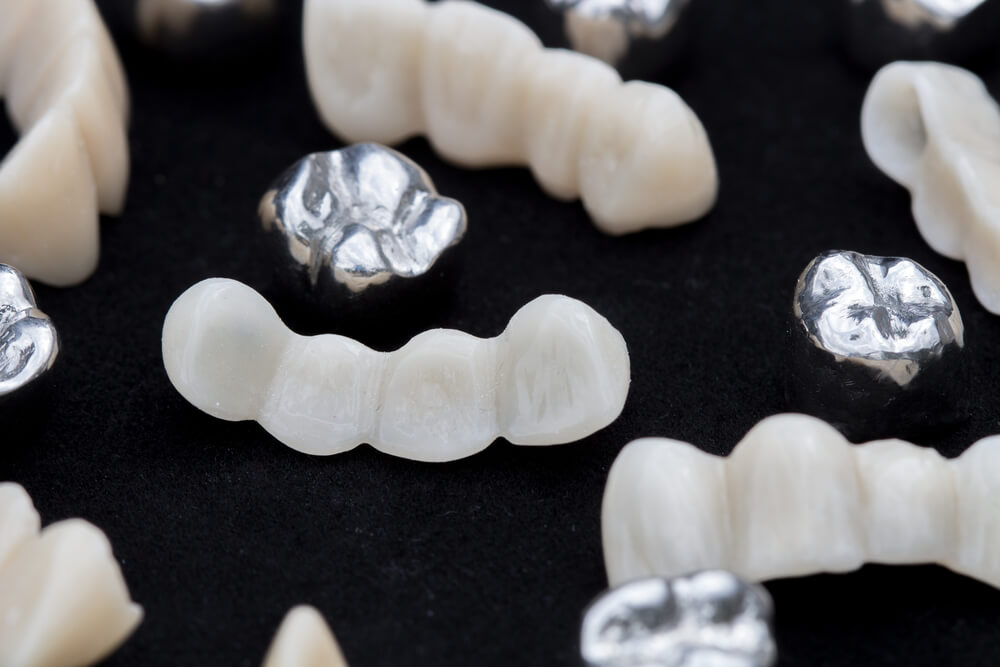 Dental silver metal tooth crowns and ceramic or zirconium tooth