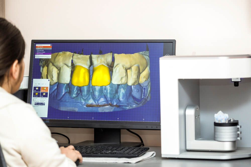 Person working on computer with dental software