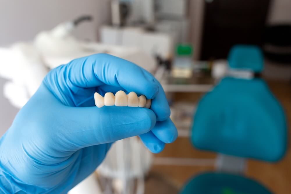 The dentist holds a ceramic