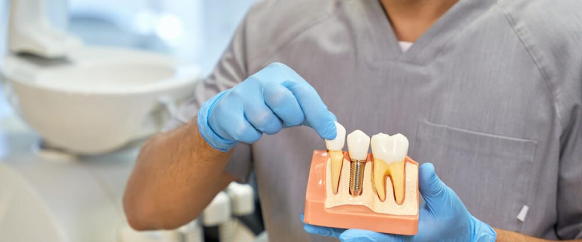 Skillful dental technician showing anatomy of dental implant