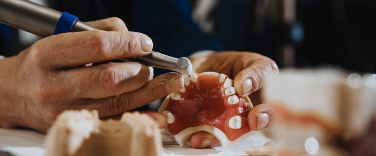 A dental technician processes a cast from the jaw of the patient.