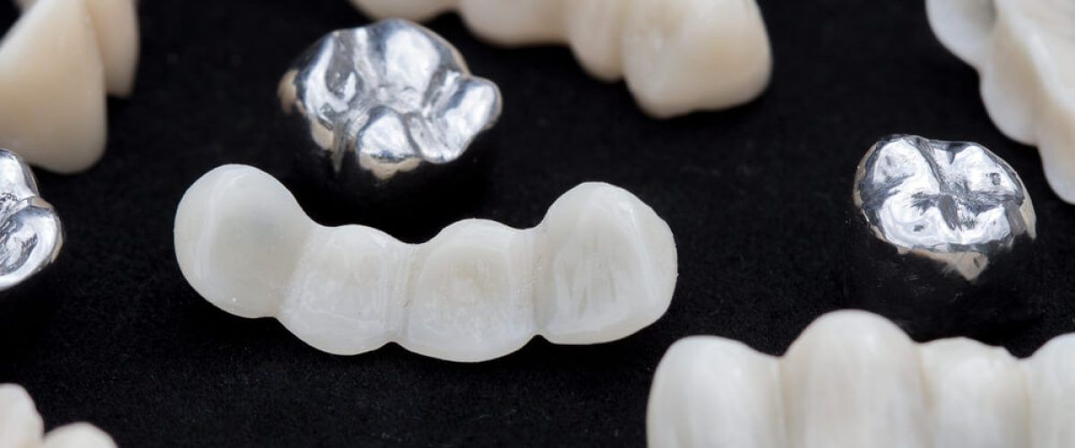 Dental silver metal tooth crowns and ceramic or zirconium tooth