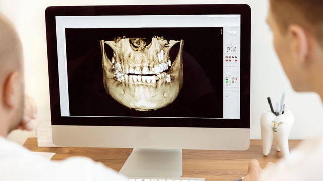 Dentists and assistant discussing the x-ray photograph on computer