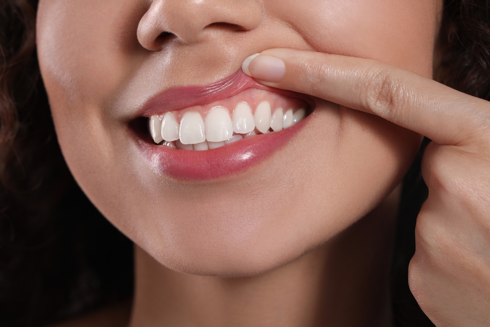 Young,Woman,Showing,Healthy,Gums,,Closeup,View