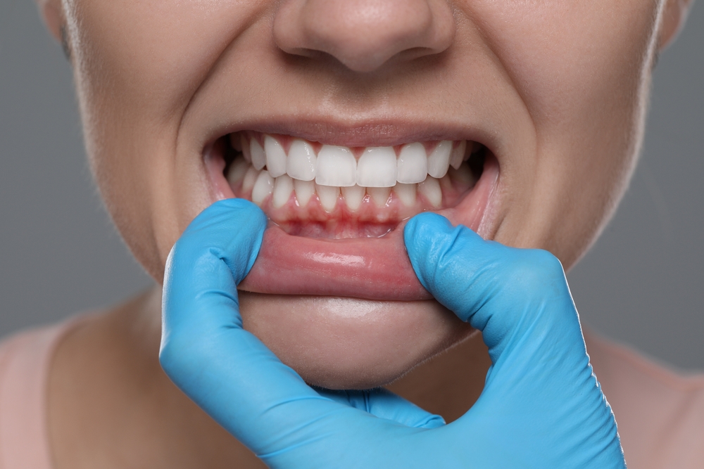 Woman,Showing,Healthy,Gums,On,Gray,Background,,Closeup