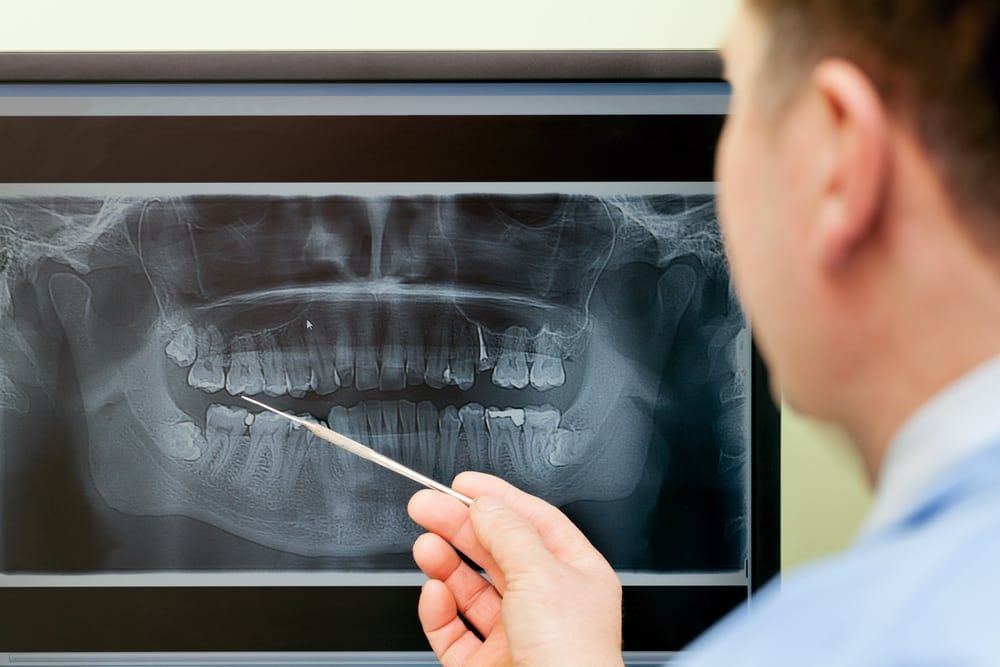 Doctor showing Digital-X-Rays of teeth