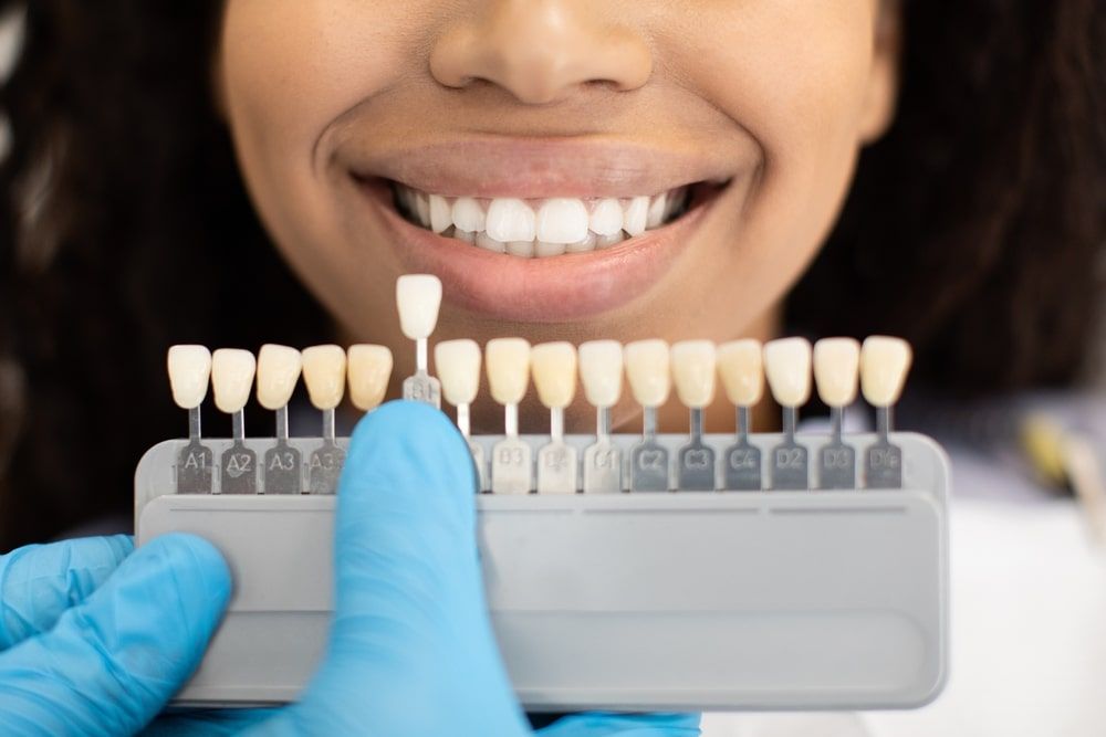 Dentist In Sterile Gloves Holding Dental Teeth Shade Guide Chart