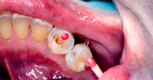 22 showing the concept of Exploring Mouth Conditions: Recognizing Signs And Seeking Treatment