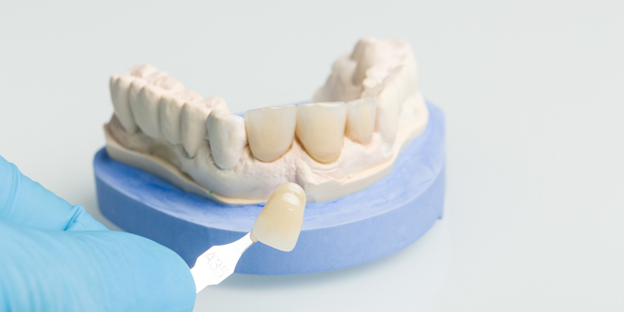 33 6 showing the concept of Enhancing Your Smile: The Role Of Veneers, Crowns, And Invisalign