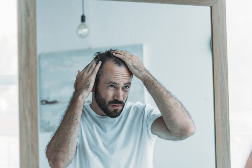 Middle aged man with hair loss looking at mirror