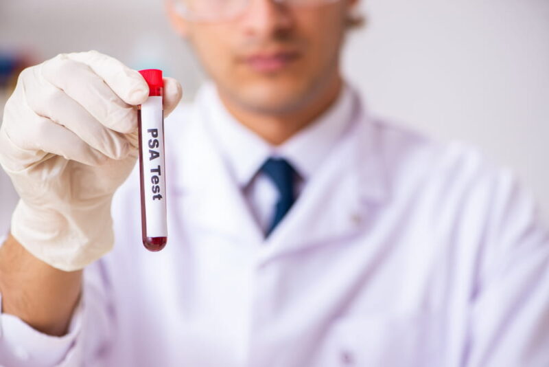 Young handsome lab assistant testing blood samples in hospital