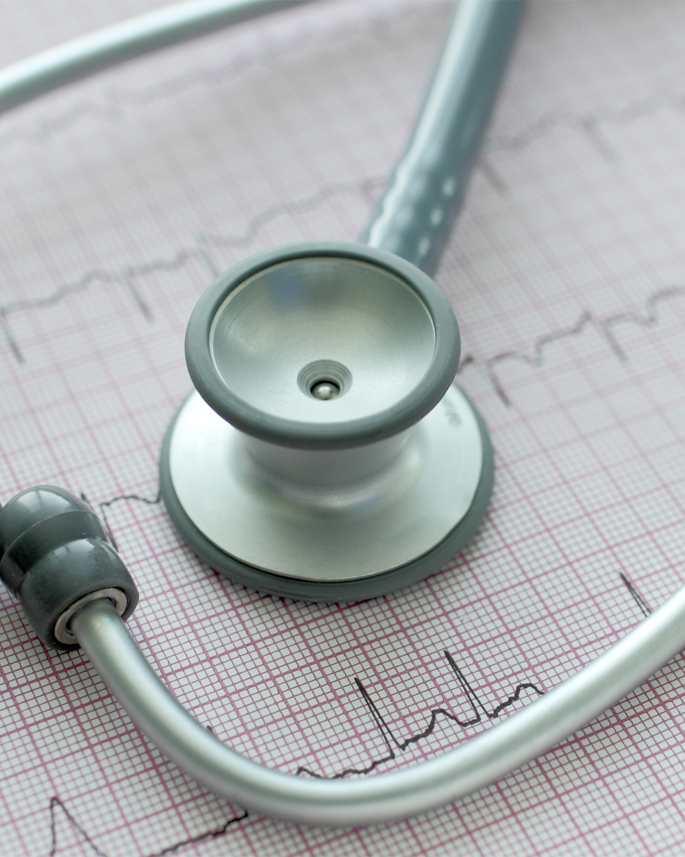 Atrial fibrillation