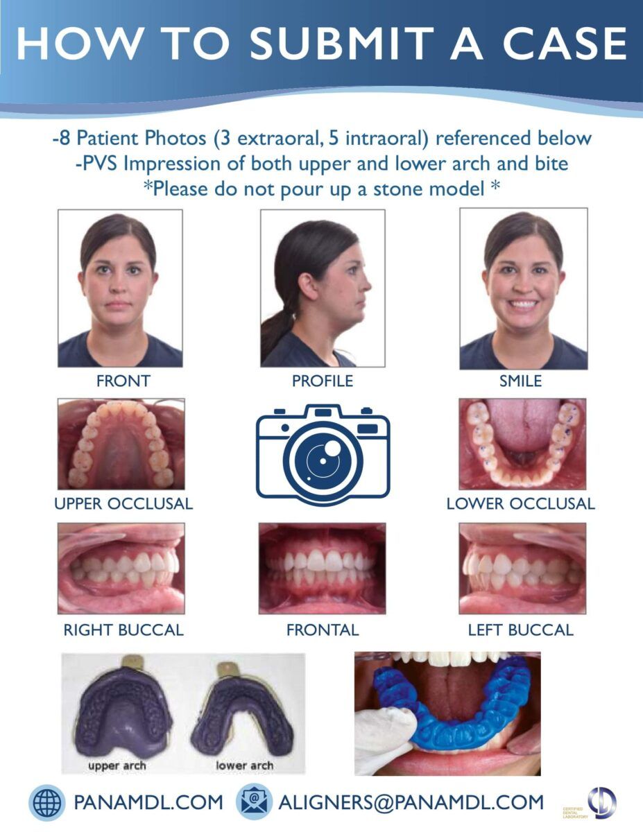 Clear Aligners Savannah, GA and Houston, TX PanAm Dental Laboratory