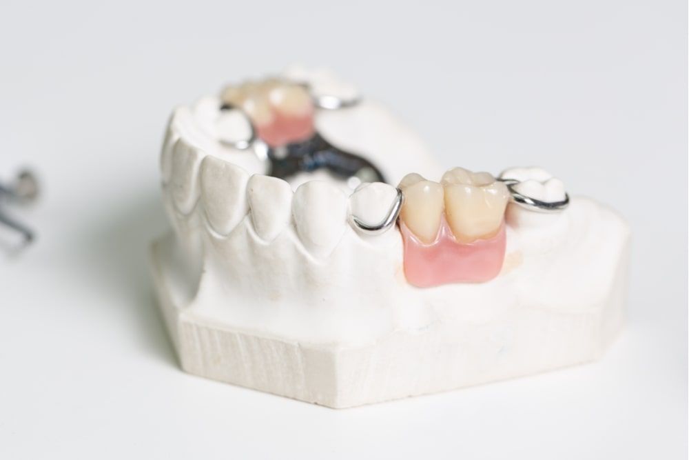 Artificial dentition in a dental laboratory