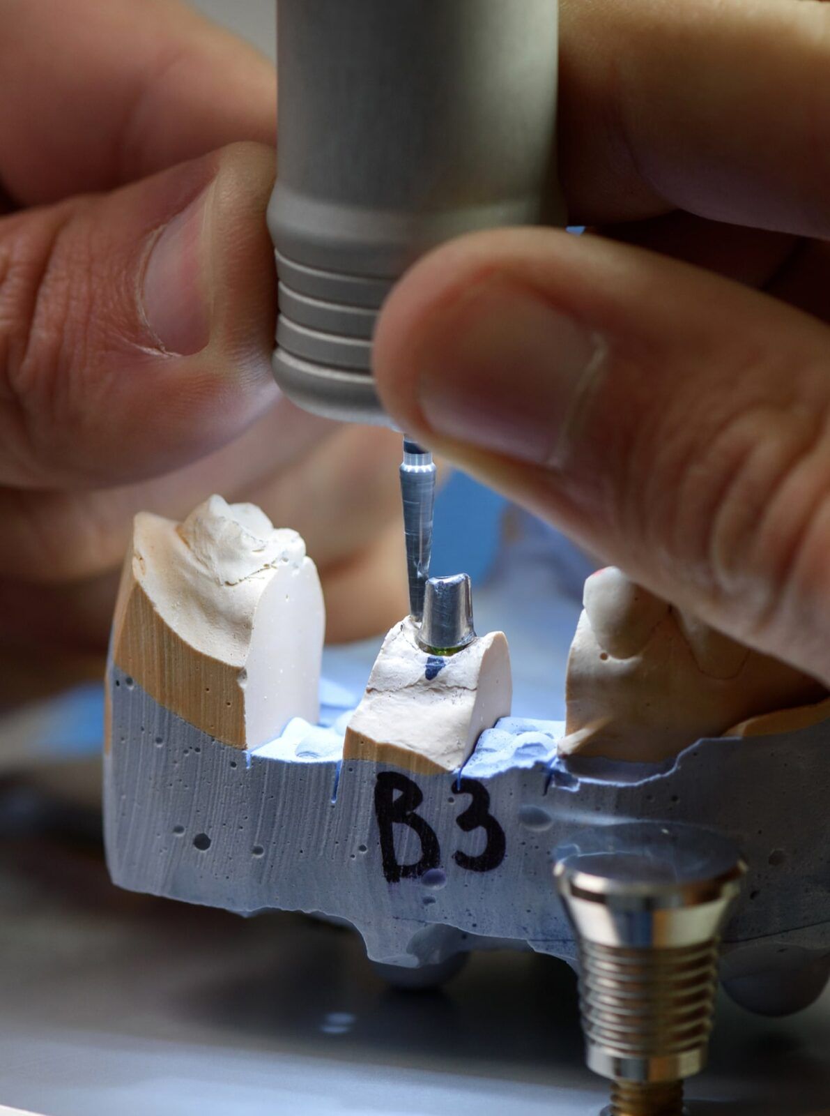 male dental technician's hands using a dental drill on tooth model to create an implant denture