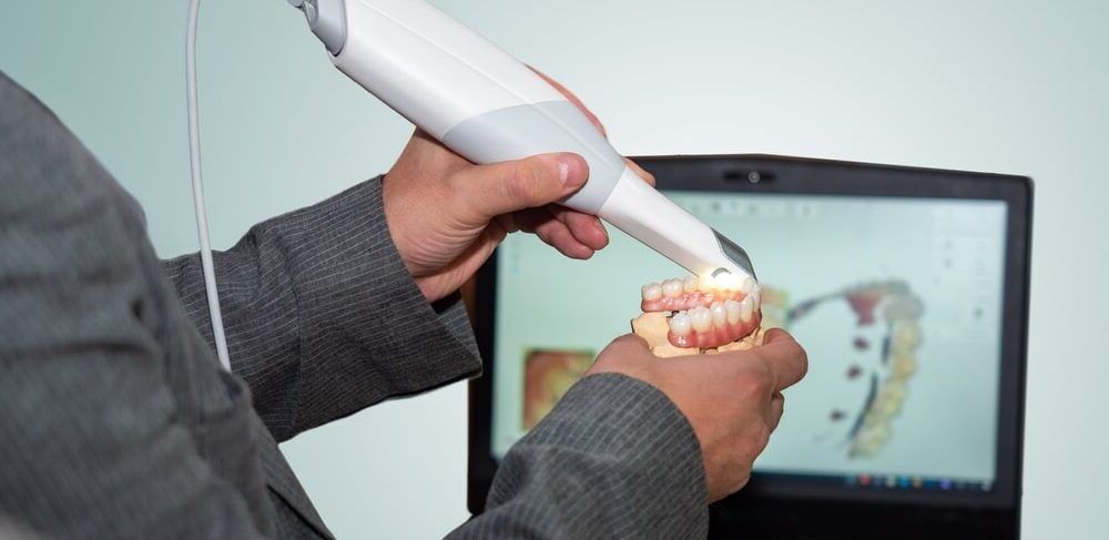 Dental intraoral scanner in hands of a man
