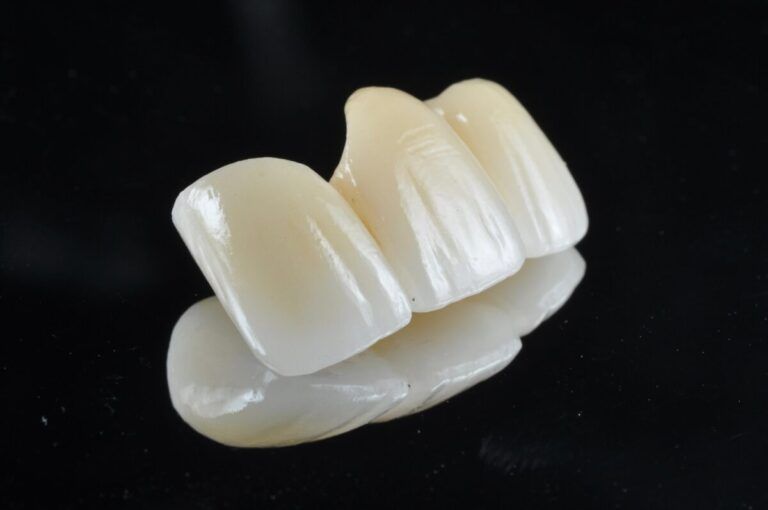 Unlocking the Advantages of Monolithic Zirconia Restorations A