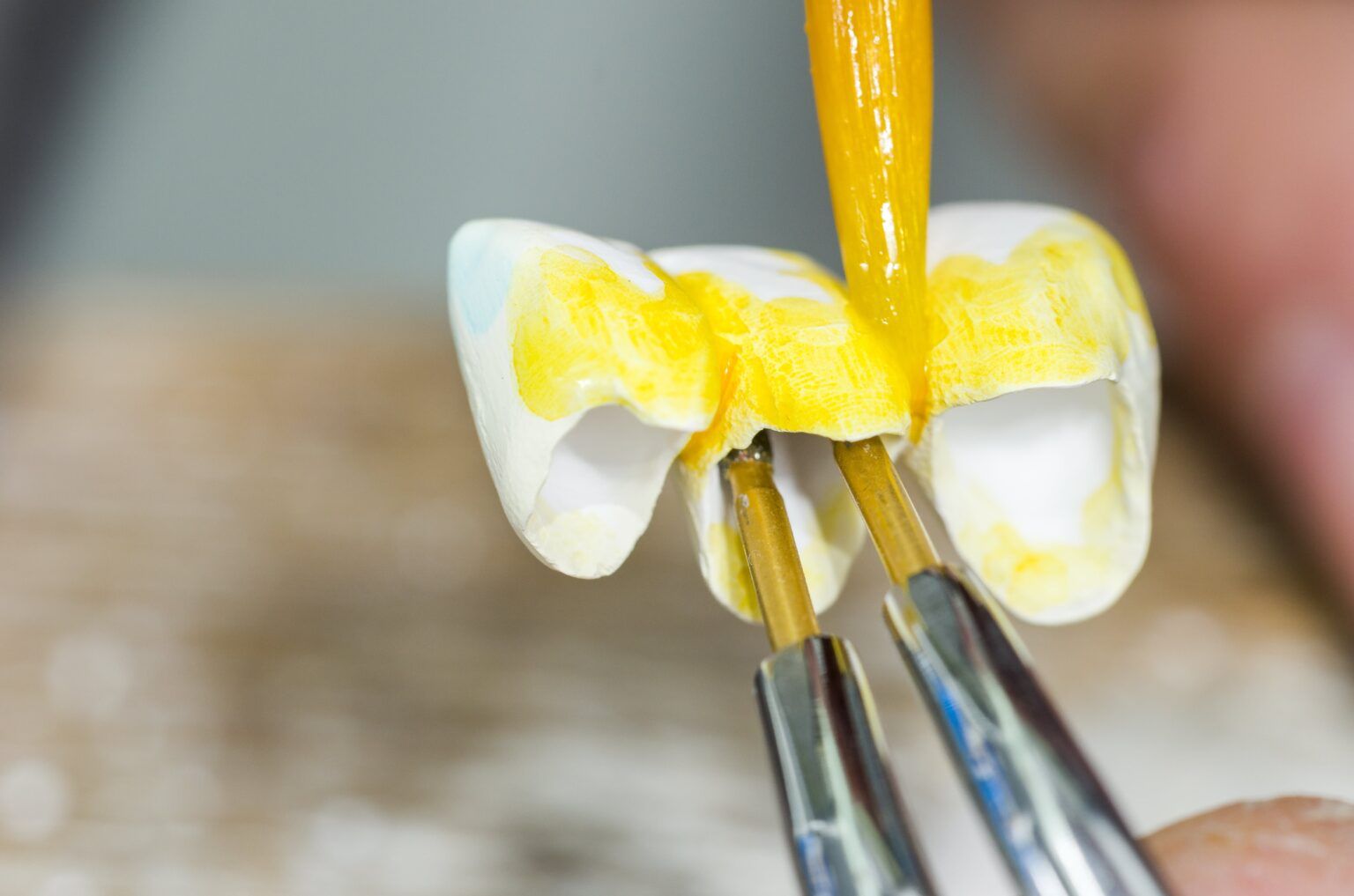 Dental Dyes and Stains Understanding Their Uses in Restorations