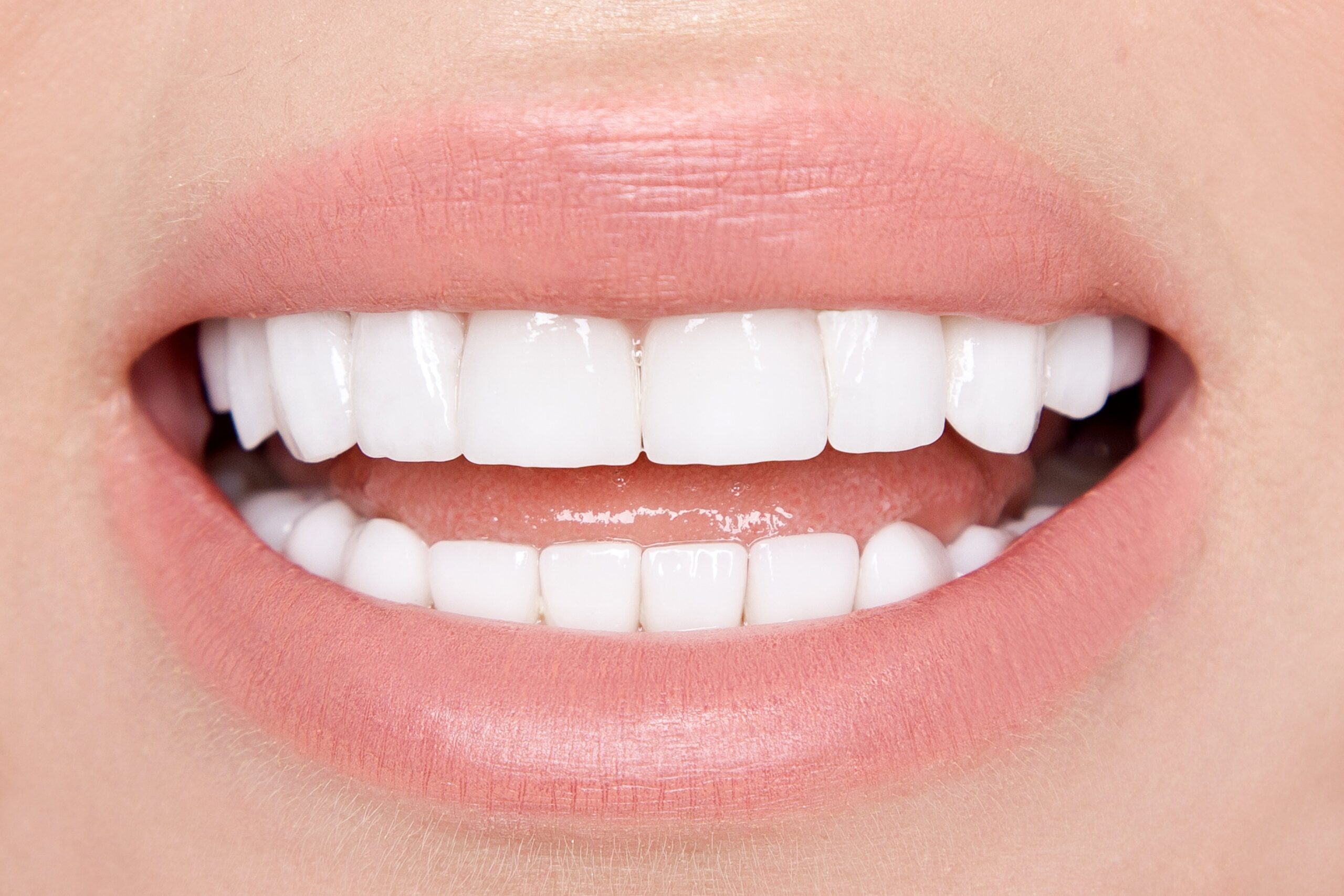 closeup of beautiful white smile