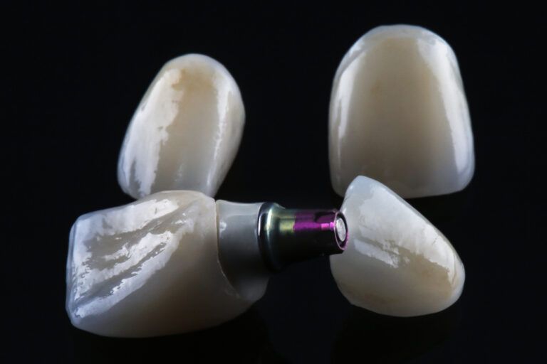 Importance of Using High-Strength Ceramics in Dental Restorations