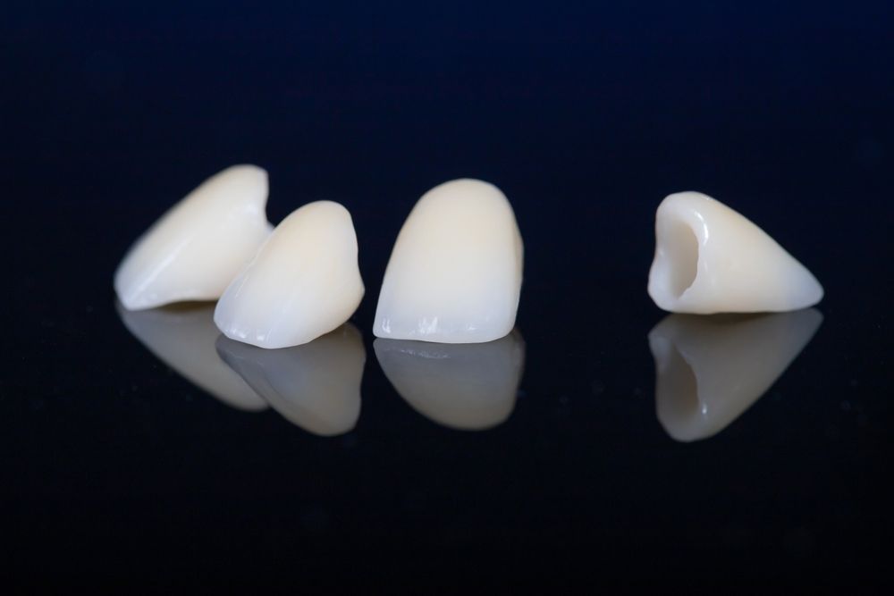 Importance of Metal-Free Restorations in Aesthetic Dentistry