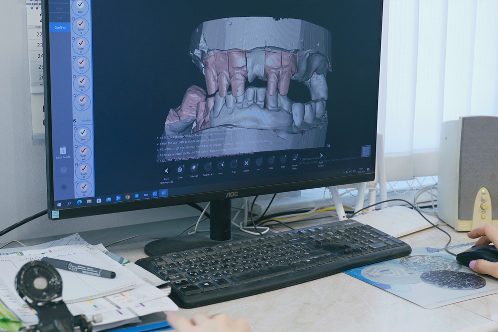 Different Types of Dental CAD Software and Their Features