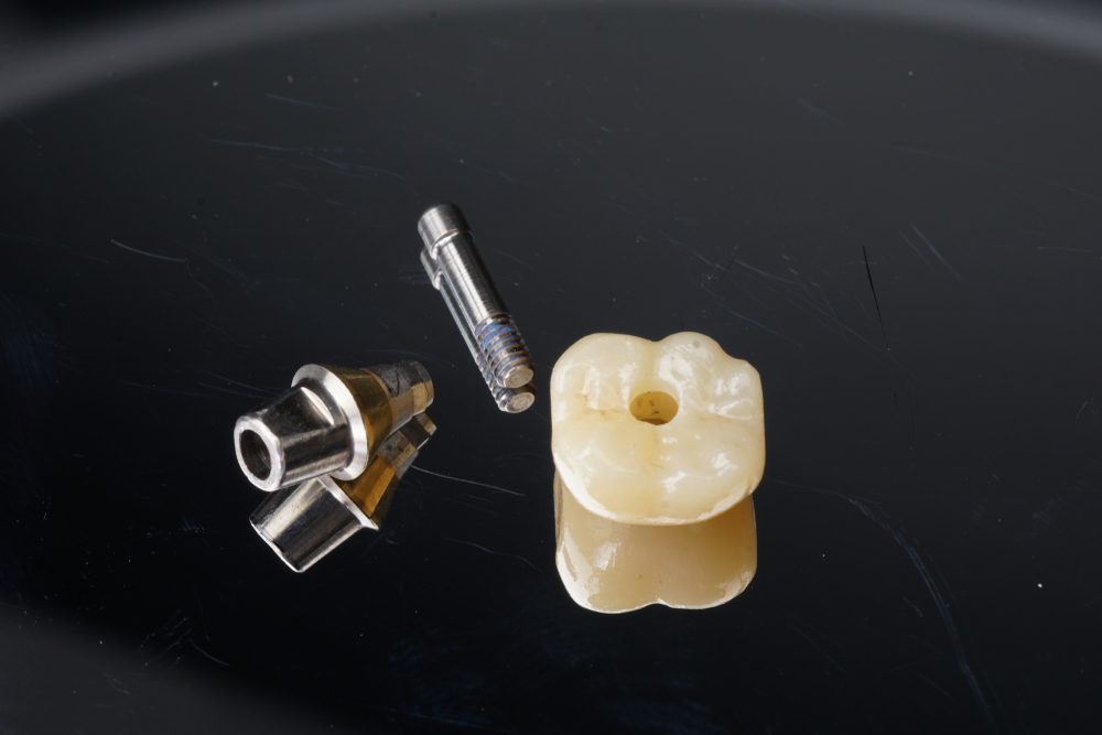 Custom-Made Implant Abutments for Zygomatic Implants