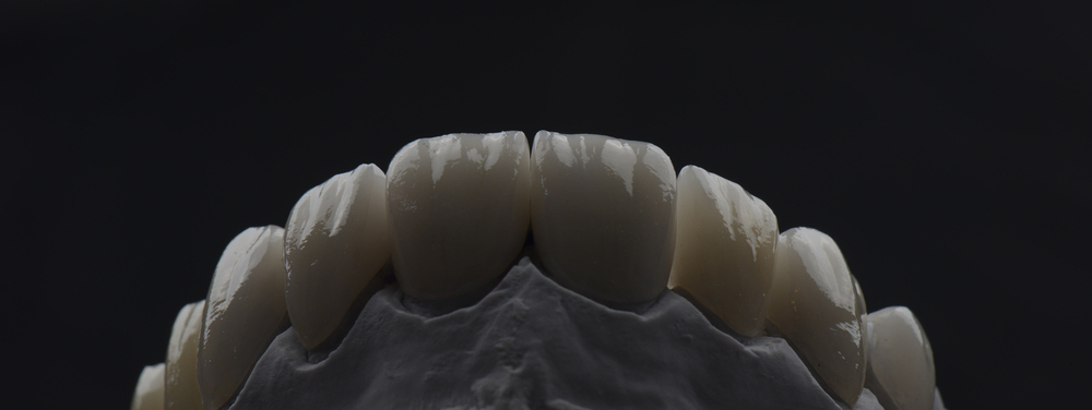 Importance of Proper Contouring for Dental Restorations