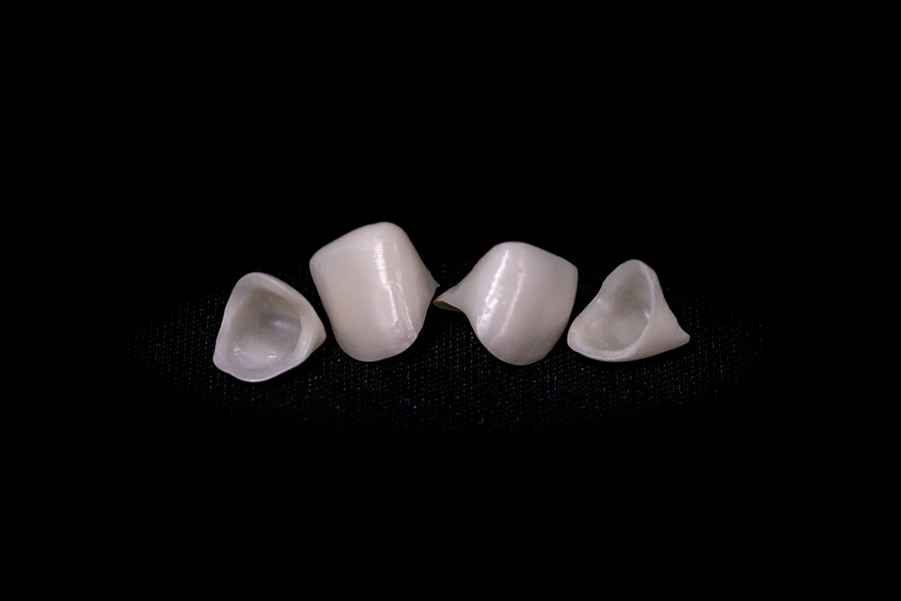Zirconia vs. Porcelain-Fused-to-Metal (PFM): Which One is Best for Patients