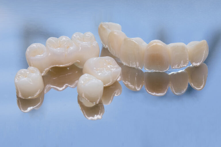 High-Strength Ceramics Improve Durability in Dental Restorations