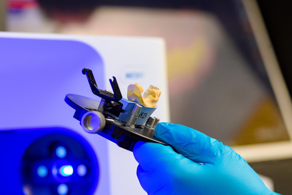 Dental scan with prosthesis. Create three-dimensional model of prosthesis.