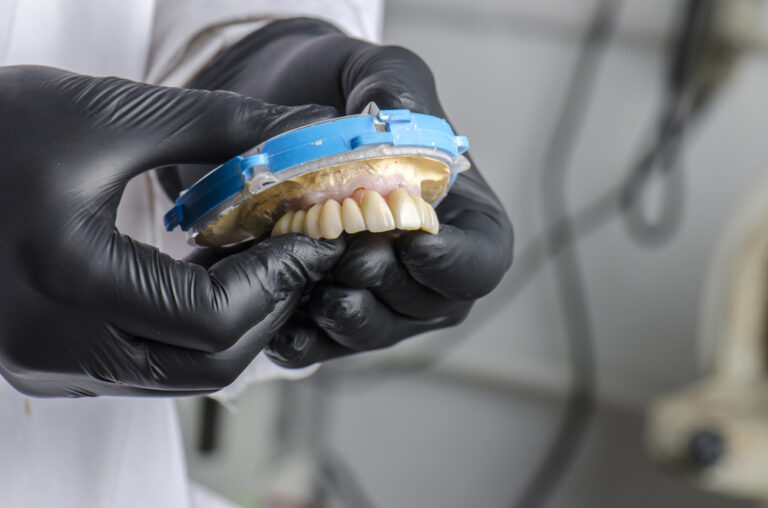 Dental technician holding a monolithic zirconia restorations full arch implant supported with the ceramic load in vestibular