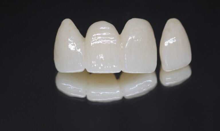 Dental Zirconia Crown and Bridge with Layering
