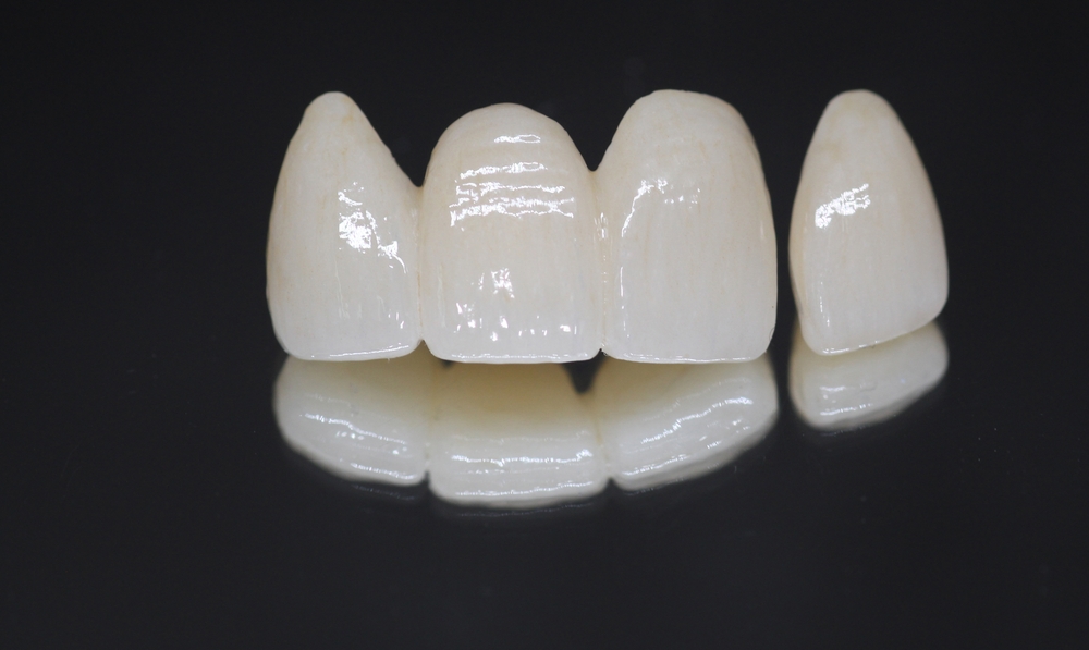 Dental Zirconia Crown and Bridge with Layering