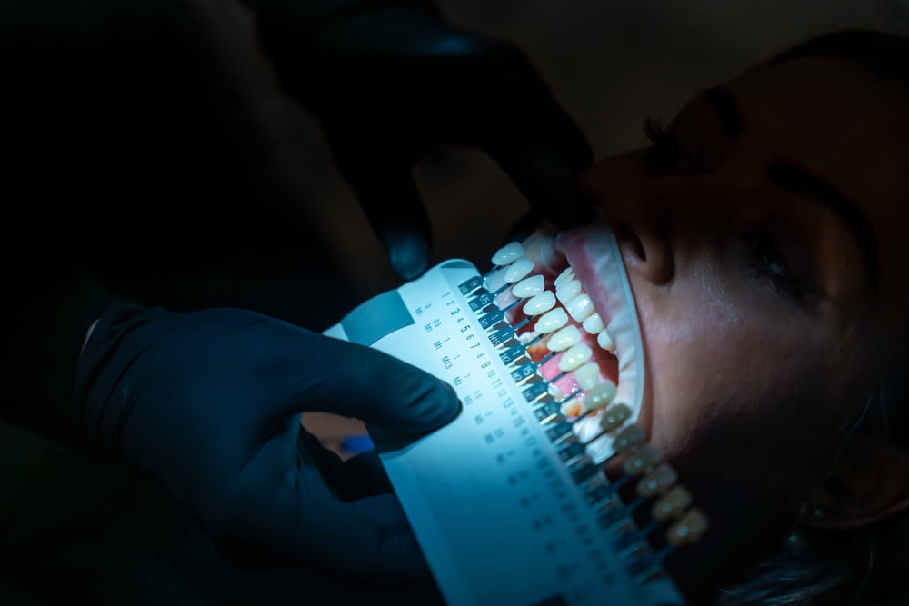 Dentist wearing black gloves comparing patient's teeth shade with samples for whitening treatment in a dental clinic