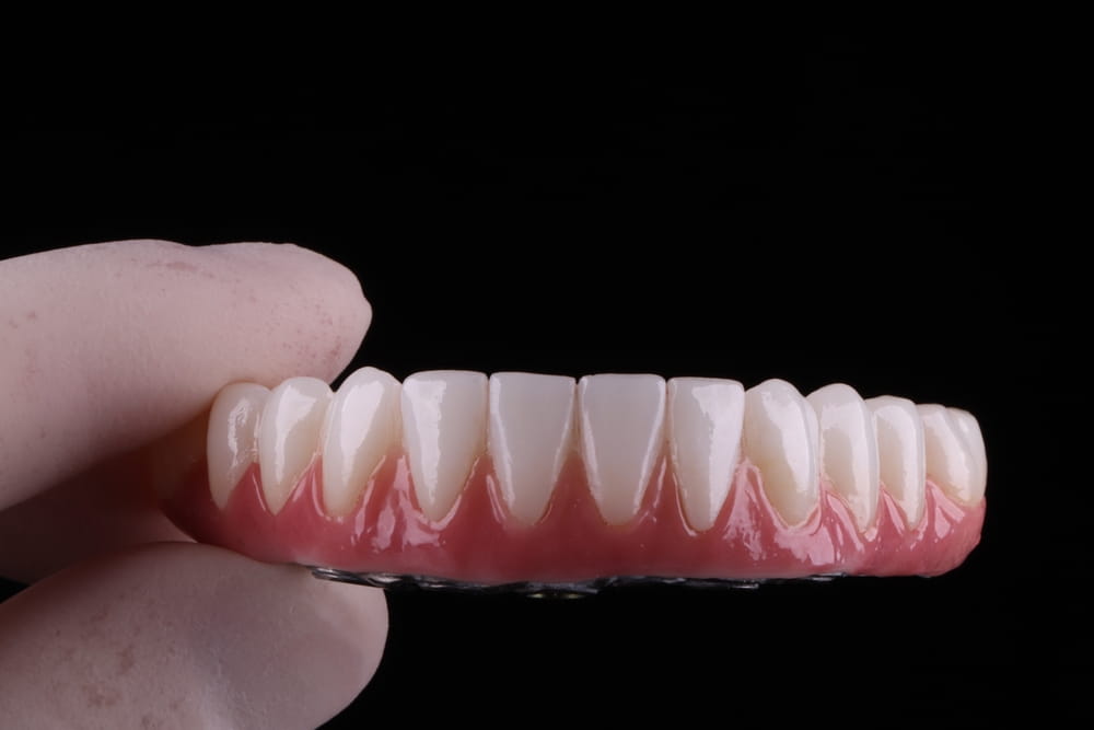 Zirconia, crown, implants, titanium, prosthetics, dental laboratory,